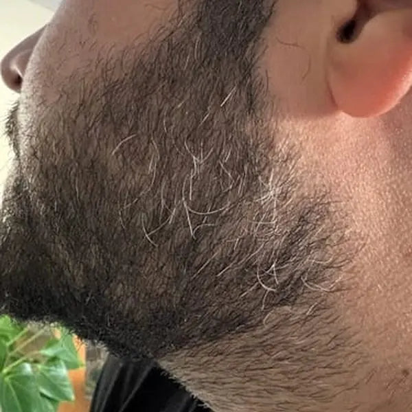 Her partner's beard before: gray hairs through a dark beard