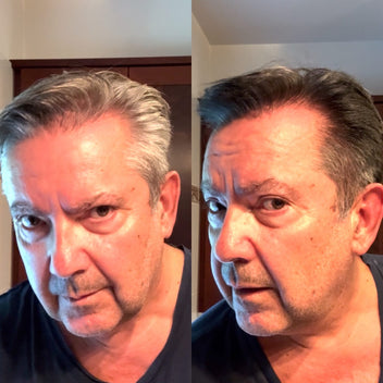 Resultado masculino