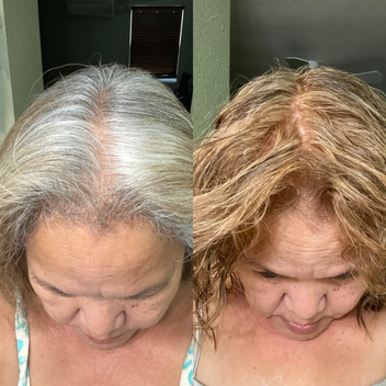 Resultado antes y después
