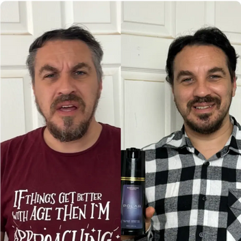 Resultado masculino después de la aplicación