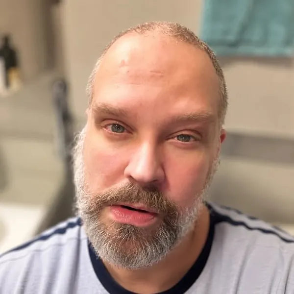 Aleksei A. before: gray beard