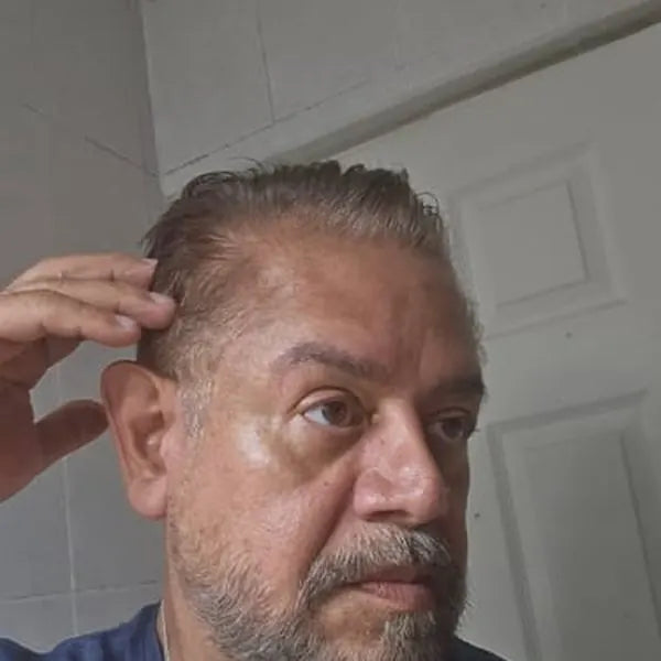 Andres L. before: gray hair and beard
