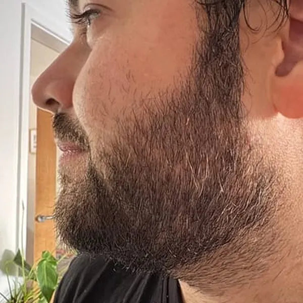 Her partner's beard after: even dark brown